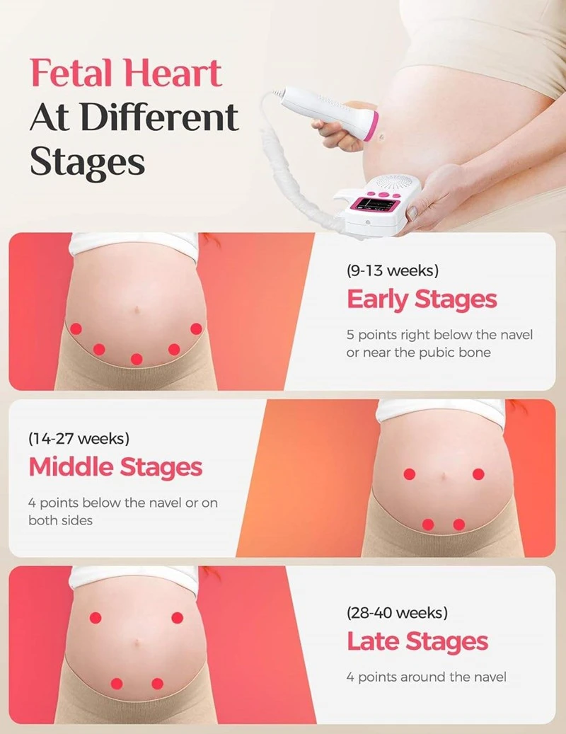 Basic Home Portable Fetal Doppler high quality